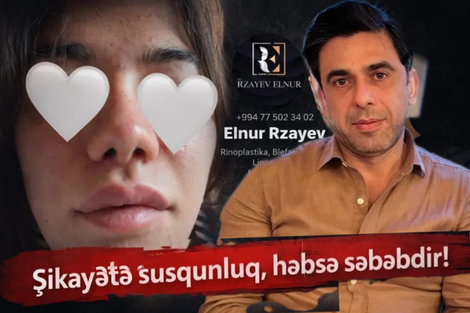 “Azərturkmed Hospital” və həkim Elnur Rzayev niyə susur? - ŞİKAYƏT